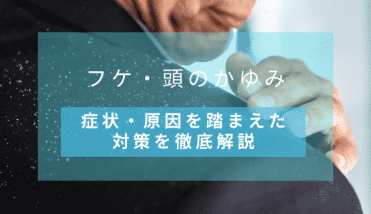 【フケ・頭のかゆみ】症状・原因を踏まえた対策を徹底解説