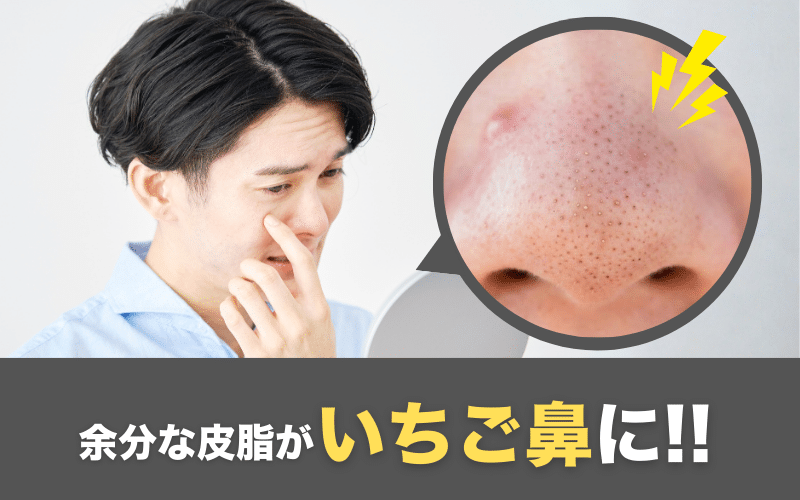 毛穴の黒ずみができるメカニズムの図解：余分な皮脂と古い角質が毛穴に詰まり角栓になる→空気に触れて酸化→黒ずみ（いちご鼻）になる3ステップのイラスト。毛穴の断面図で皮脂が詰まっている様子を可視化