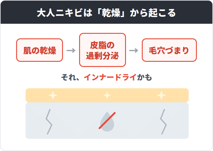 肌の乾燥から皮脂の過剰分泌・毛穴づまりが起こる仕組みと、表面は皮脂でテカっても内部は乾燥するインナードライの状態を示した図